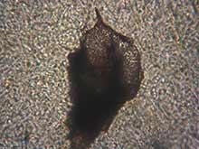 Mesostoma ehrenbergi, Glas-Strudelwurm: Becher-Auge.